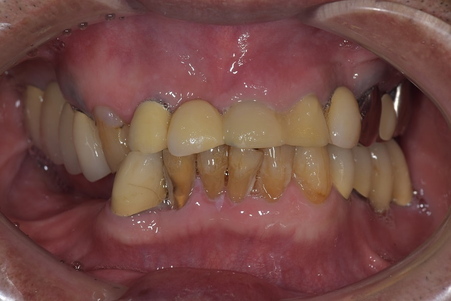 総合的な歯科治療