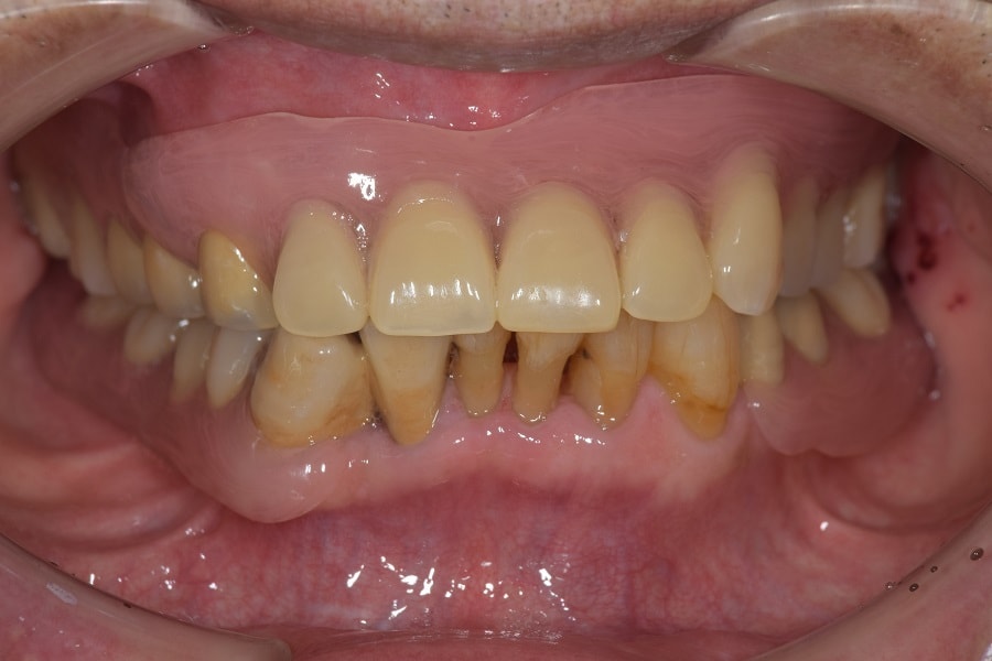 総合的な歯科治療